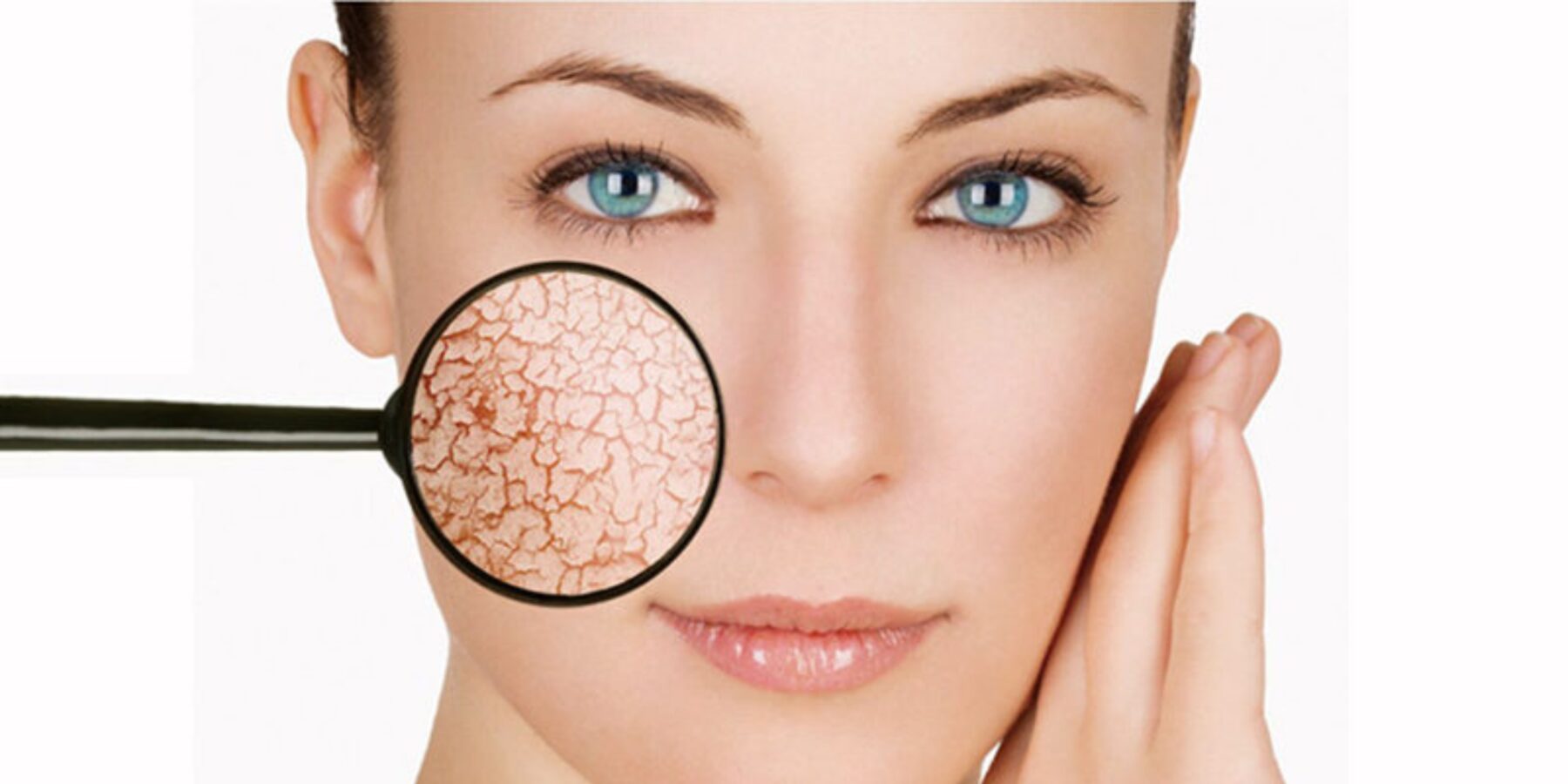 Страшне слово “демодекоз” – що це, як лікувати?