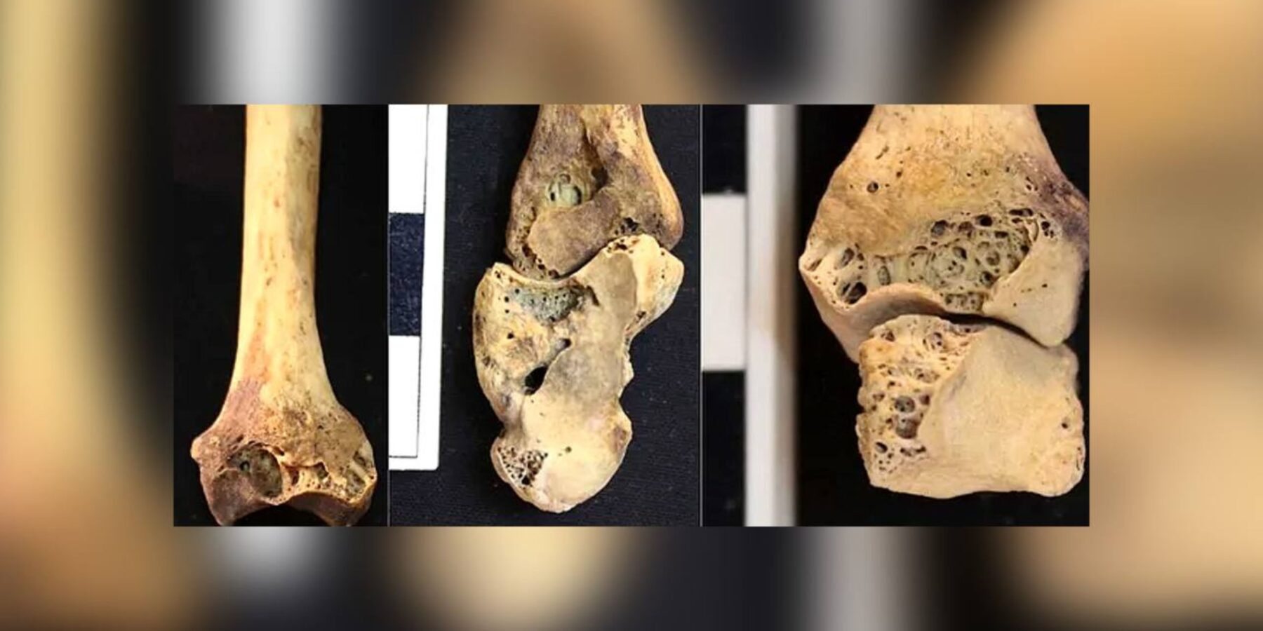 В Єгипті знайшли 3500-річний скелет нубійки, уражений ревматоїдним артритом