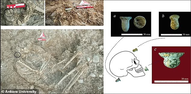 У Туреччині знайшли сліди пірсингу на скелетах віком 11 тисяч років