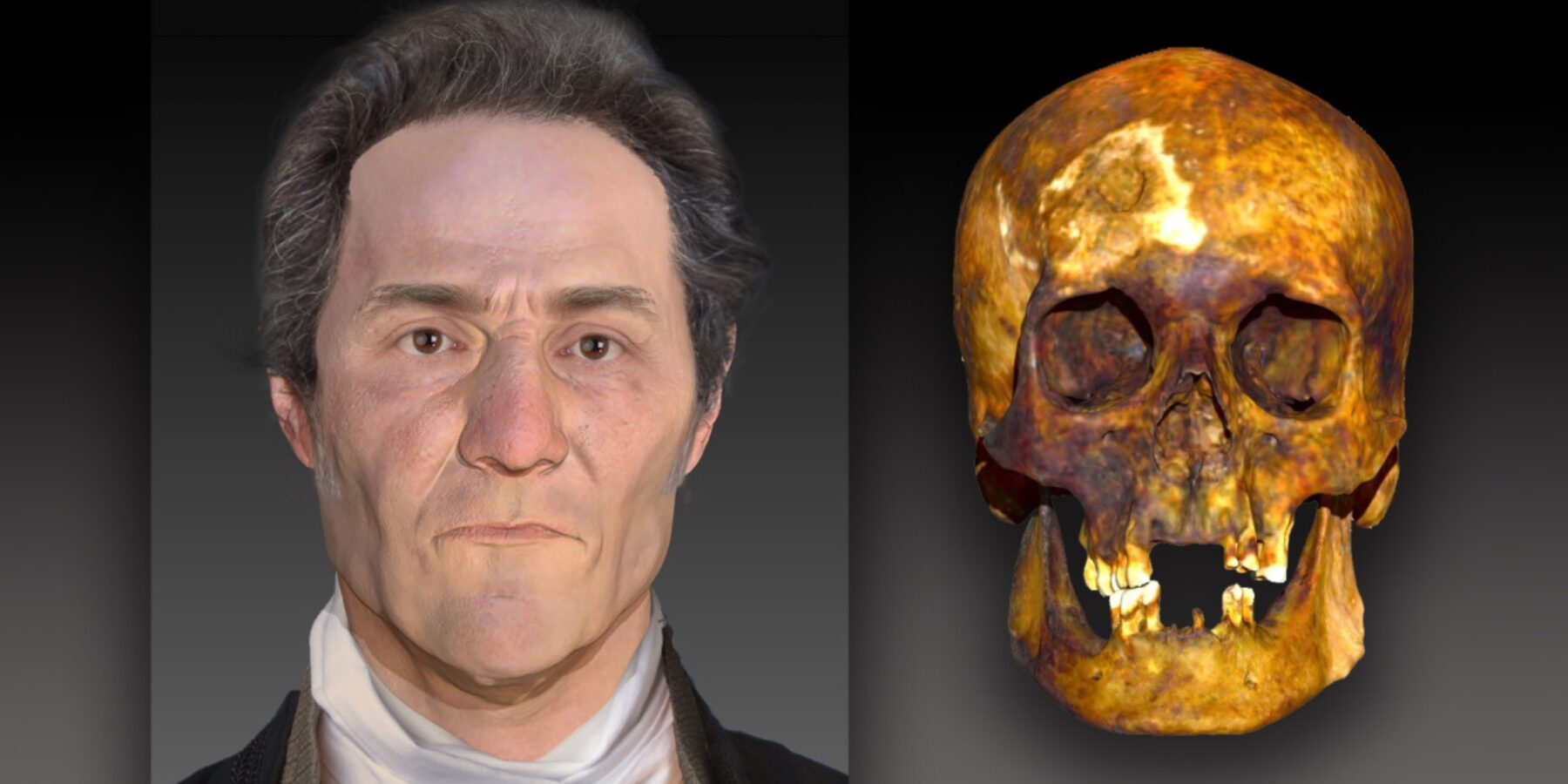 Науковці реконструювали зовнішність «вампіра» XIX століття Науковці реконструювали зовнішність «вампіра» XIX століття