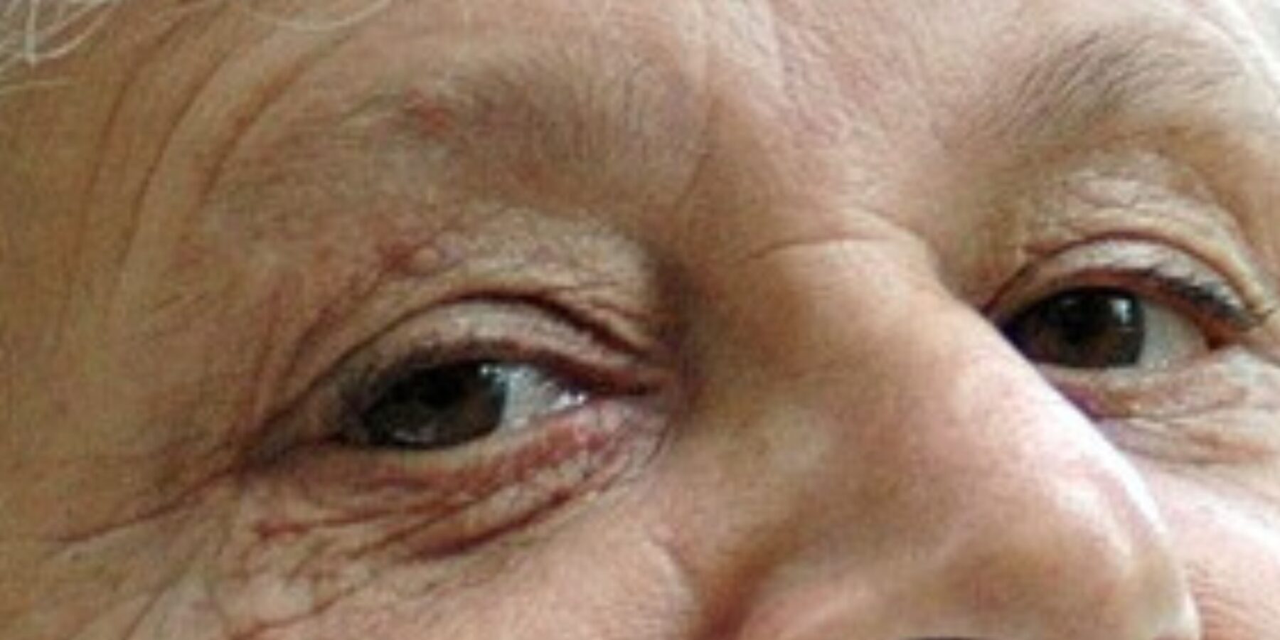 Вчені нарешті встановили причину появи вікових зморшок у людей