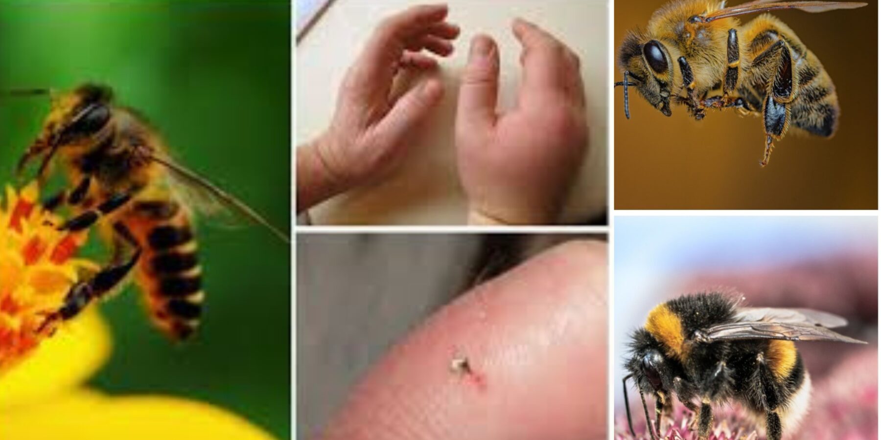 Сезонна небезпека: чому укуси бджіл та ос можуть бути смертельно небезпечними