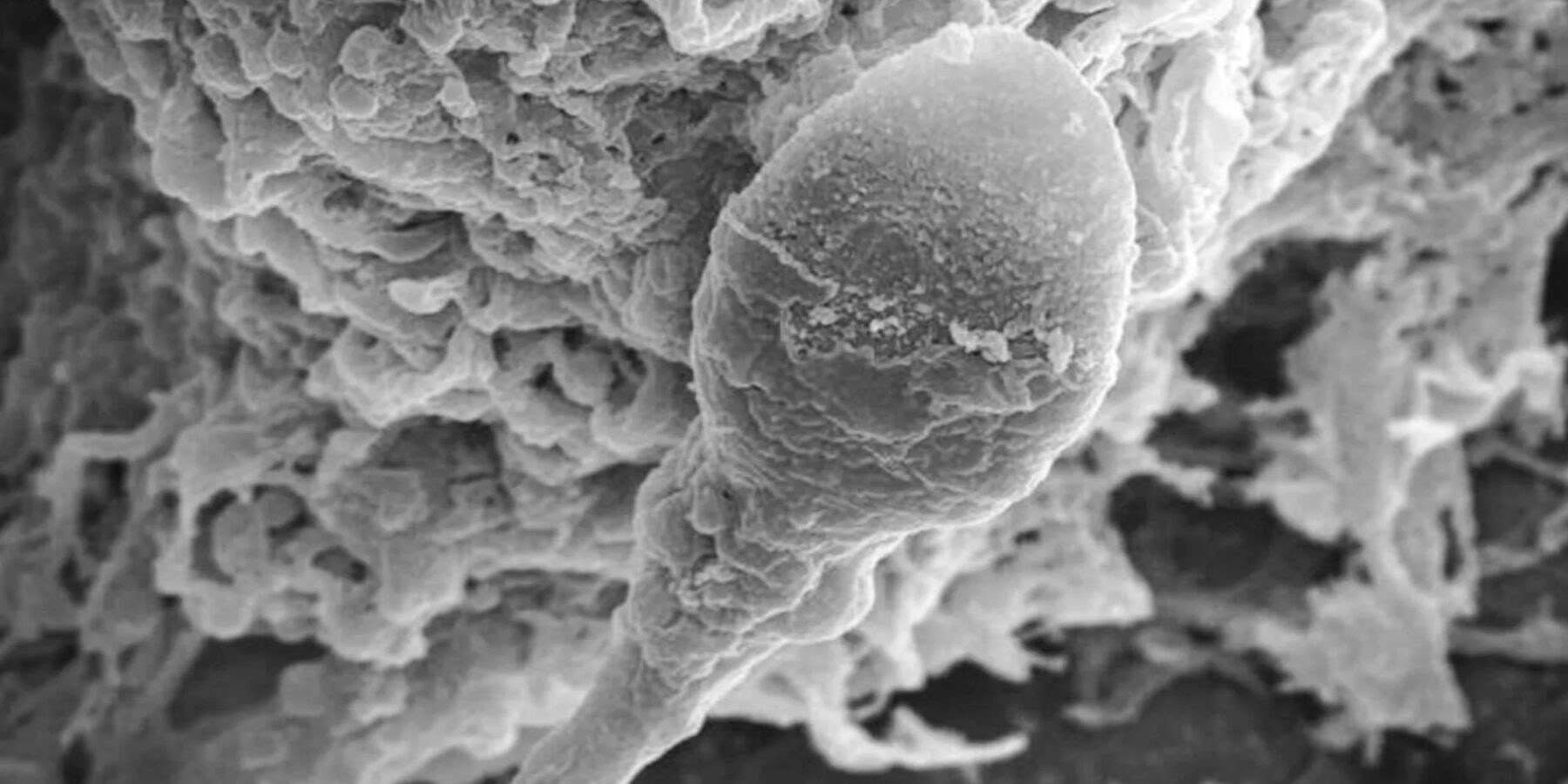 Вчені з Австралії дослідили вплив мікрогравітації на сперматозоїди