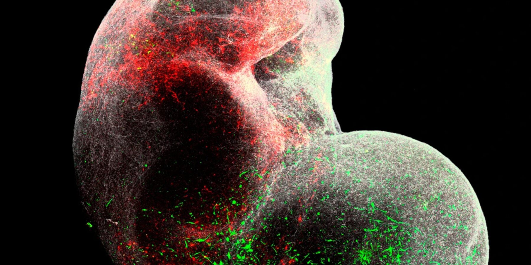 Вчені створили «міні-мозки», що відкривають нову еру в нейронауці