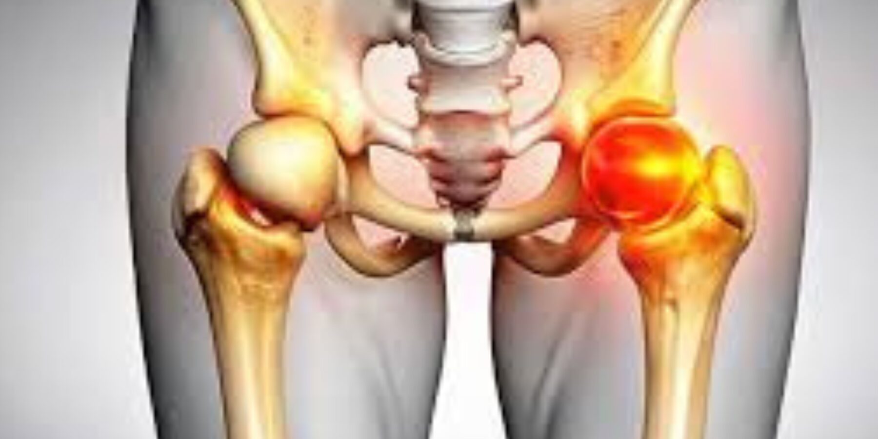 Чому кульшовий суглоб стає проблемою XXI століття
