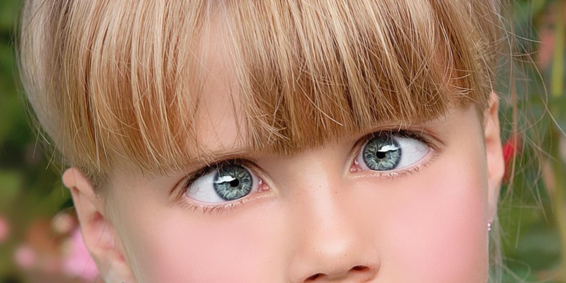 Косоокість у дітей: чому важливо лікувати вчасно