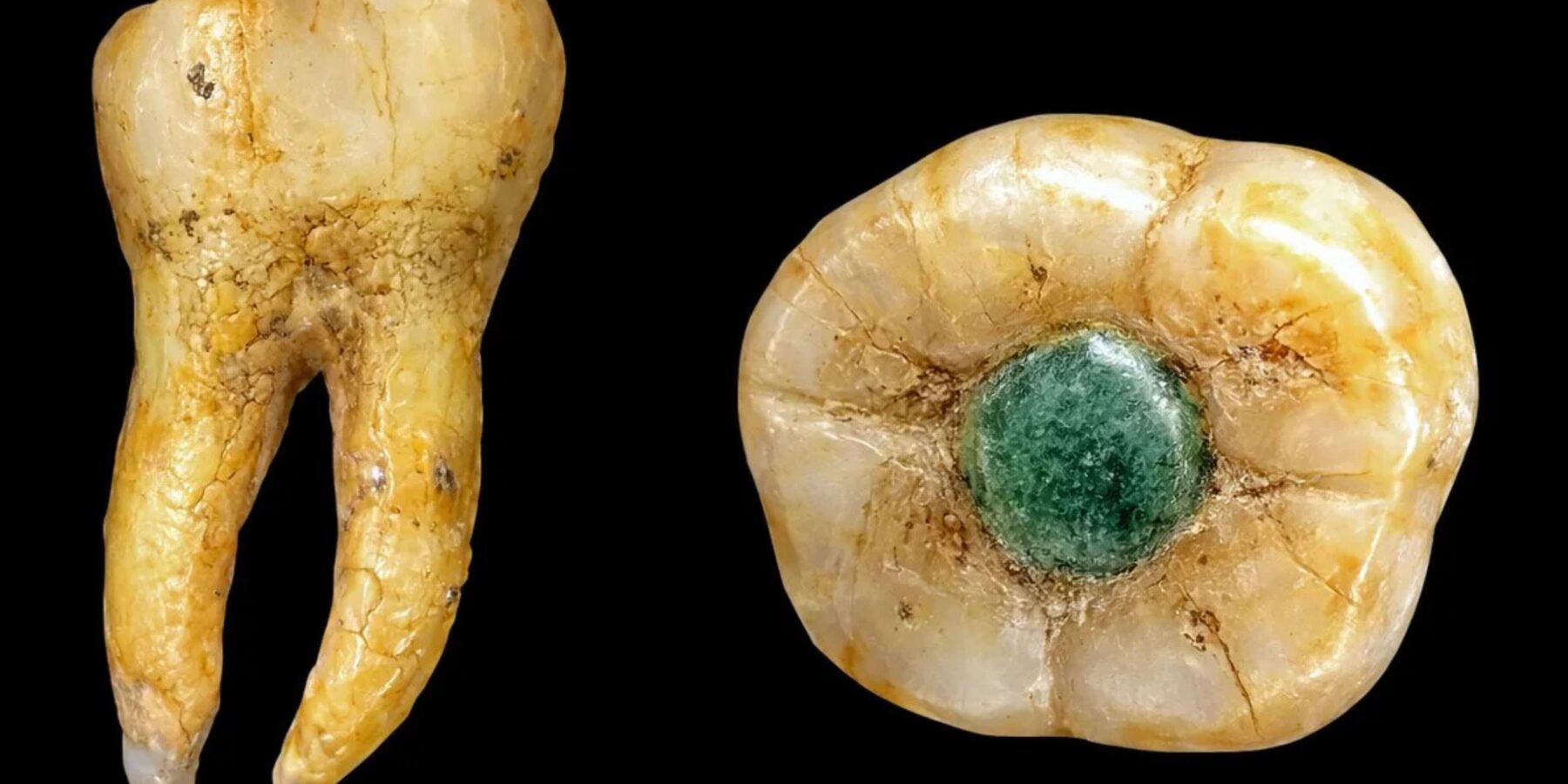 Археологи знайшли унікальний зуб майя з інкрустацією яшмою
